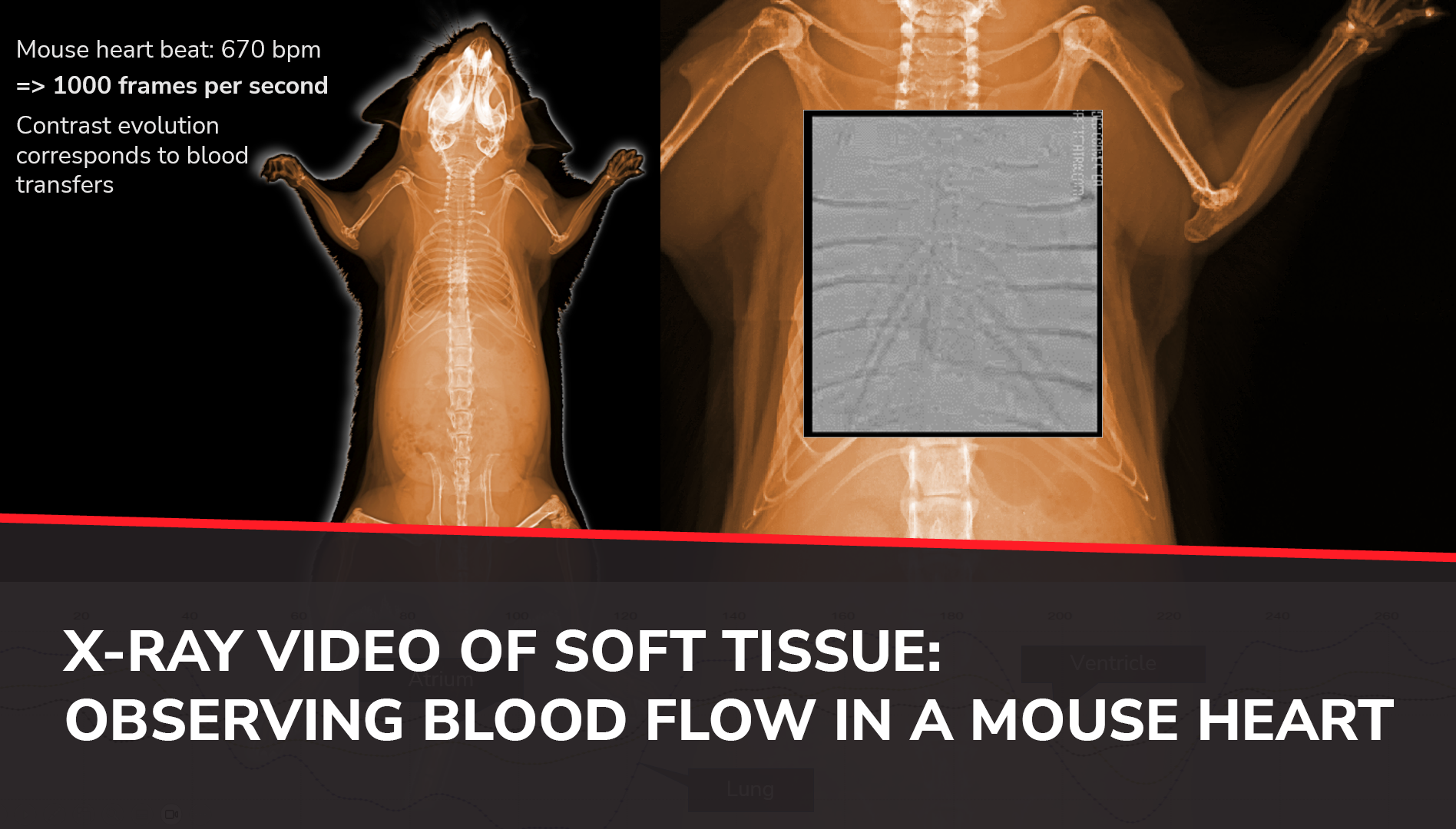 Hey doc, can you Xray blood flow in my heart?